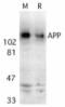 Amyloid Beta Precursor Protein antibody, TA306003, Origene, Western Blot image 