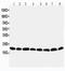 Peroxiredoxin 5 antibody, PA1838, Boster Biological Technology, Western Blot image 