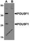 POU Class 5 Homeobox 1 antibody, A00174, Boster Biological Technology, Western Blot image 