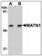 Matrilin 1 antibody, AP23871PU-N, Origene, Western Blot image 