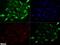 NUT Midline Carcinoma Family Member 1 antibody, NBP2-31146, Novus Biologicals, Immunofluorescence image 