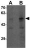 Phospholipase A1 member A antibody, GTX32097, GeneTex, Western Blot image 