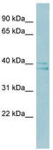 RAD51-associated protein 1 antibody, TA345967, Origene, Western Blot image 
