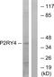 P2Y purinoceptor 4 antibody, GTX87199, GeneTex, Western Blot image 