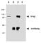 TPX2 Microtubule Nucleation Factor antibody, GTX00510, GeneTex, Immunoprecipitation image 