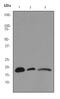 EDB antibody, ab76021, Abcam, Western Blot image 