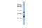 Ornithine Decarboxylase Antizyme 2 antibody, GTX45061, GeneTex, Western Blot image 