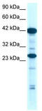 Homeobox protein SIX6 antibody, TA330276, Origene, Western Blot image 