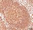 CD45 antibody, V2243IHC-7ML, NSJ Bioreagents, Immunohistochemistry paraffin image 