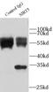 Sirtuin 5 antibody, FNab07883, FineTest, Immunoprecipitation image 
