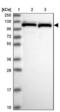 Pre-MRNA Processing Factor 6 antibody, NBP1-92298, Novus Biologicals, Western Blot image 
