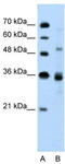 CUGBP Elav-Like Family Member 3 antibody, TA329318, Origene, Western Blot image 