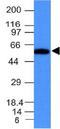 Fascin Actin-Bundling Protein 1 antibody, orb388662, Biorbyt, Western Blot image 