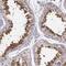 Sperm surface protein Sp17 antibody, PA5-58013, Invitrogen Antibodies, Immunohistochemistry frozen image 