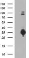 CD74 Molecule antibody, NBP2-46179, Novus Biologicals, Western Blot image 