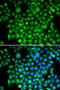 CFI antibody, STJ27590, St John