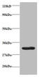G Protein-Coupled Receptor 161 antibody, A53973-100, Epigentek, Western Blot image 