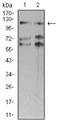 SWI/SNF Related, Matrix Associated, Actin Dependent Regulator Of Chromatin, Subfamily A, Member 1 antibody, NBP2-61879, Novus Biologicals, Western Blot image 
