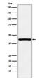 Homeobox protein Hox-A13 antibody, M03305, Boster Biological Technology, Western Blot image 