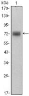 Zinc Finger And BTB Domain Containing 16 antibody, abx012177, Abbexa, Enzyme Linked Immunosorbent Assay image 