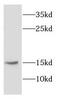 Cytochrome B5 Reductase 3 antibody, FNab02186, FineTest, Western Blot image 
