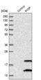 Phosphatidylinositol Glycan Anchor Biosynthesis Class P antibody, NBP1-84294, Novus Biologicals, Western Blot image 