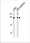 Sarcospan antibody, TA325100, Origene, Western Blot image 