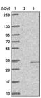Ciliary Associated Calcium Binding Coiled-Coil 1 antibody, PA5-59550, Invitrogen Antibodies, Western Blot image 