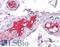 Protein C, Inactivator Of Coagulation Factors Va And VIIIa antibody, LS-B4277, Lifespan Biosciences, Immunohistochemistry paraffin image 