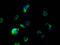 Solute Carrier Family 5 Member 5 antibody, LS-C681382, Lifespan Biosciences, Immunofluorescence image 