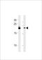 Family With Sequence Similarity 216 Member B antibody, LS-C203947, Lifespan Biosciences, Western Blot image 