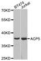 Acid Phosphatase 5, Tartrate Resistant antibody, LS-C332141, Lifespan Biosciences, Western Blot image 
