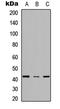 Scd antibody, LS-C354483, Lifespan Biosciences, Western Blot image 