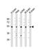 Carbohydrate Sulfotransferase 1 antibody, M10029, Boster Biological Technology, Western Blot image 