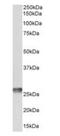 Mitochondrially Encoded ATP Synthase Membrane Subunit 6 antibody, orb233611, Biorbyt, Western Blot image 