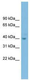 Forkhead Box H1 antibody, TA343436, Origene, Western Blot image 