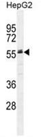 AHSG antibody, AP50120PU-N, Origene, Western Blot image 