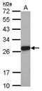 Chymotrypsin-like elastase family member 3A antibody, NBP2-14946, Novus Biologicals, Western Blot image 