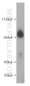 CTD Small Phosphatase Like 2 antibody, 17532-1-AP, Proteintech Group, Western Blot image 