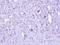 Zinc Finger CCCH-Type Containing 8 antibody, GTX107008, GeneTex, Immunohistochemistry paraffin image 