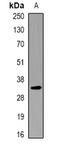 Potassium voltage-gated channel subfamily E member 1 antibody, abx225257, Abbexa, Western Blot image 