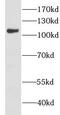 Chromosome transmission fidelity protein 18 homolog antibody, FNab01701, FineTest, Western Blot image 