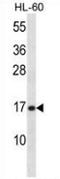 Phospholipase A2 Group V antibody, AP53325PU-N, Origene, Western Blot image 