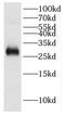 Defective In Cullin Neddylation 1 Domain Containing 5 antibody, FNab02279, FineTest, Western Blot image 