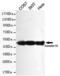 Keratin 18 antibody, TA346989, Origene, Western Blot image 