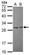 HECT Domain E3 Ubiquitin Protein Ligase 2 antibody, GTX117974, GeneTex, Western Blot image 