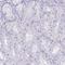 Keratin, type II cytoskeletal 78 antibody, HPA039724, Atlas Antibodies, Immunohistochemistry frozen image 