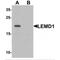LEM Domain Containing 1 antibody, MBS151350, MyBioSource, Western Blot image 
