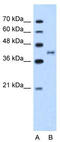 Bradykinin Receptor B2 antibody, TA346209, Origene, Western Blot image 