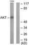 Protein kinase B antibody, TA313255, Origene, Western Blot image 